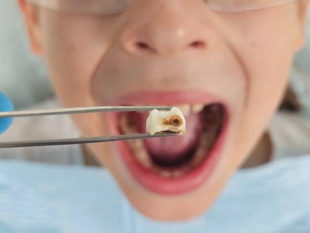 Best Emergency Gum Treatment in Iuka, MS